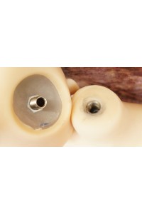 【中古】AXB Doll #84ヘッド130cm バスト大 ゼリー胸 新骨格 肌色 ナチュラル